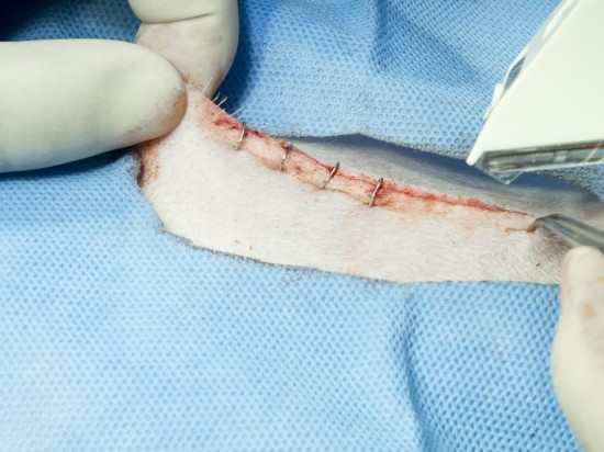 Żywienie po zabiegach operacyjnych jamy brzusznej