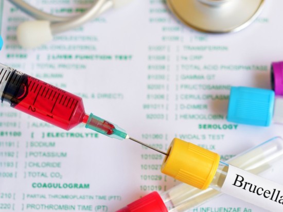 Zoonozy - choroby odzwierzęce